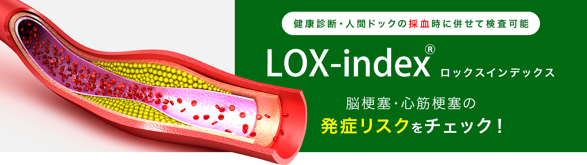 健康診断・人間ドックの採血時に併せて検査可能 ロックスインデックス 脳梗塞・心筋梗塞の発症リスクをチェック！